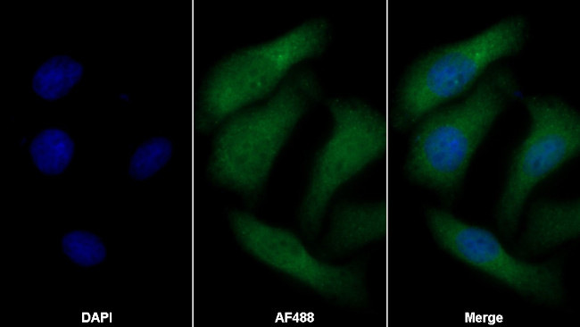 COL4A5 Antibody in Immunocytochemistry (ICC/IF)