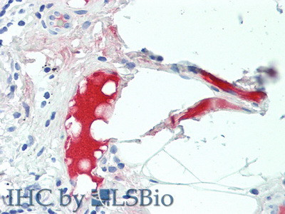 Complement C4b Antibody in Immunohistochemistry (Paraffin) (IHC (P))