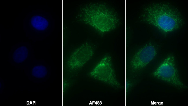 C1QBP Antibody in Immunocytochemistry (ICC/IF)