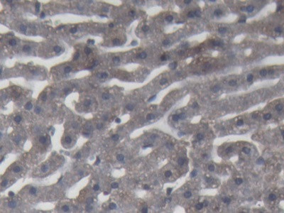 Complement C9 Antibody in Immunohistochemistry (Paraffin) (IHC (P))