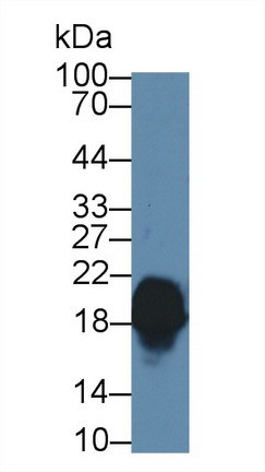 CPLX1 Antibody in Western Blot (WB)