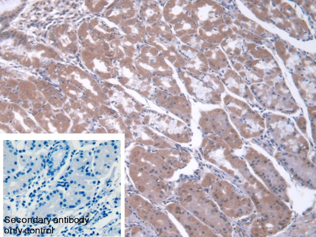 CBF beta Antibody in Immunohistochemistry (Paraffin) (IHC (P))