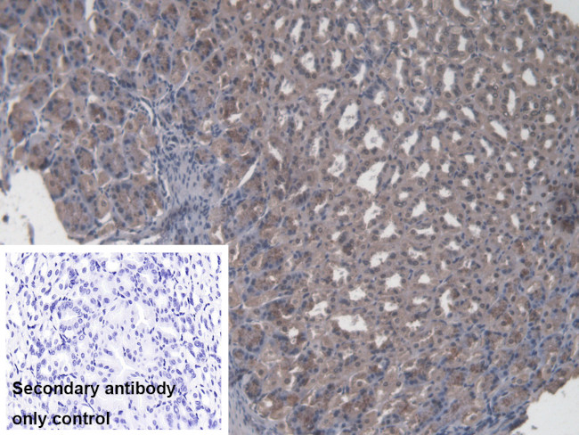 CBF beta Antibody in Immunohistochemistry (Paraffin) (IHC (P))