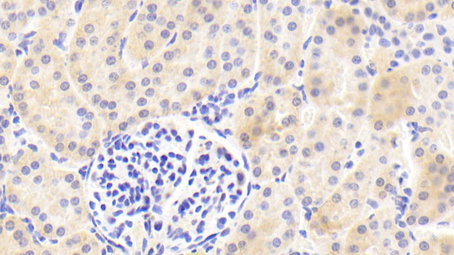 SERPINA6 Antibody in Immunohistochemistry (Paraffin) (IHC (P))