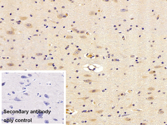 beta L Crystallin Antibody in Immunohistochemistry (Paraffin) (IHC (P))