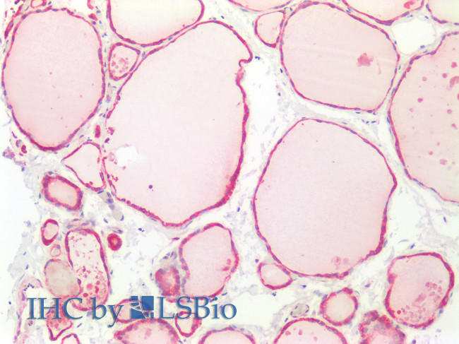 DCL-1 Antibody in Immunohistochemistry (Paraffin) (IHC (P))