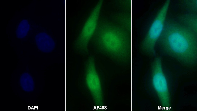 Cyclin D1 Antibody in Immunocytochemistry (ICC/IF)
