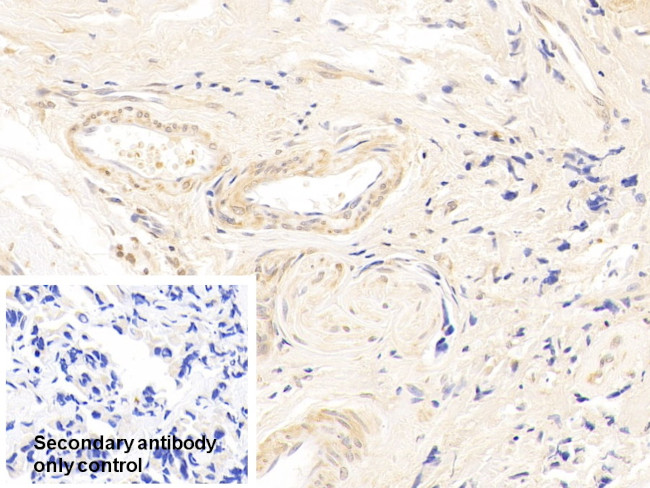 CDK4 Antibody in Immunohistochemistry (Paraffin) (IHC (P))