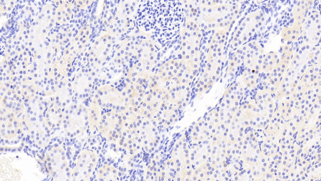 CSRP1 Antibody in Immunohistochemistry (Paraffin) (IHC (P))