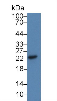 CDO1 Antibody in Western Blot (WB)