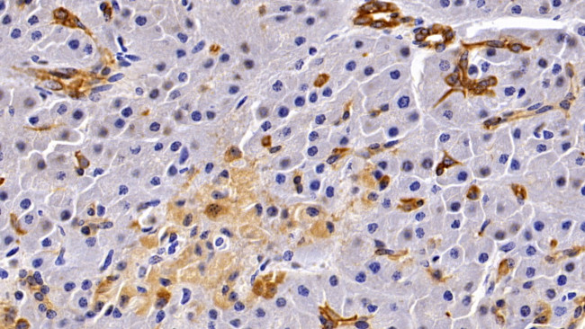 Cytokeratin 19 Antibody in Immunohistochemistry (Paraffin) (IHC (P))