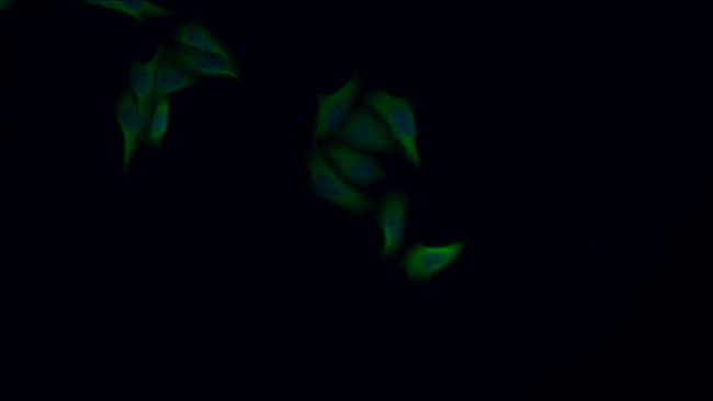 Cytokeratin 8 Antibody in Immunocytochemistry (ICC/IF)