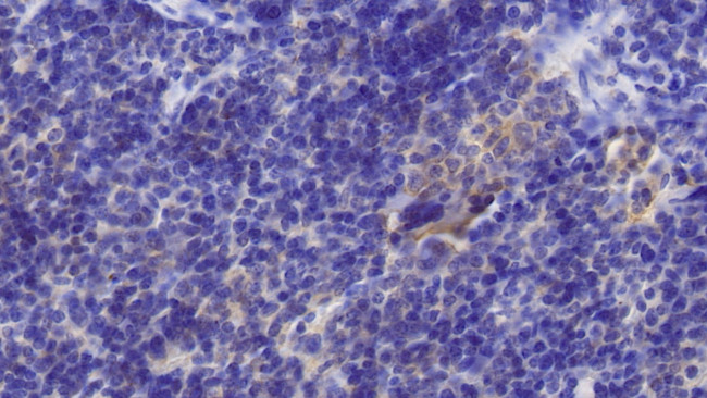 TRAIL-R2 (DR5) Antibody in Immunohistochemistry (Paraffin) (IHC (P))