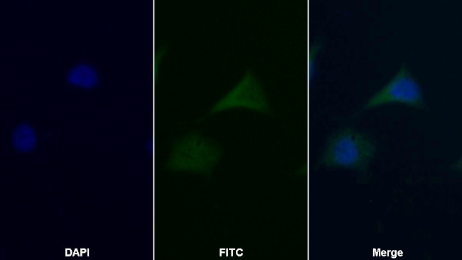 TRAIL-R2 (DR5) Antibody in Immunocytochemistry (ICC/IF)