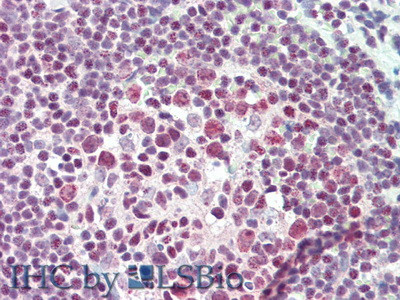 CD148 Antibody in Immunohistochemistry (Paraffin) (IHC (P))
