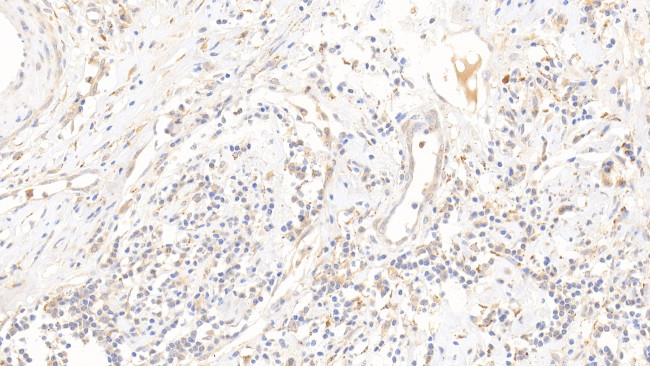 DPP3 Antibody in Immunohistochemistry (Paraffin) (IHC (P))