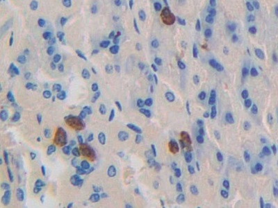 Dynamin 1 Antibody in Immunohistochemistry (Paraffin) (IHC (P))