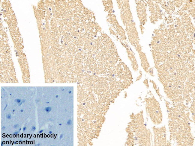 NSE Antibody in Immunohistochemistry (Paraffin) (IHC (P))