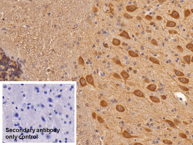 NSE Antibody in Immunohistochemistry (Paraffin) (IHC (P))