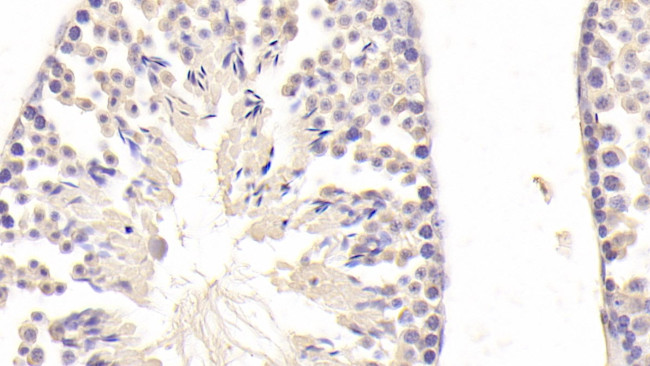 DSPG3 Antibody in Immunohistochemistry (Paraffin) (IHC (P))