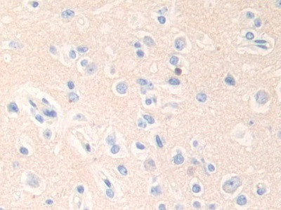 Epsin 1 Antibody in Immunohistochemistry (Paraffin) (IHC (P))