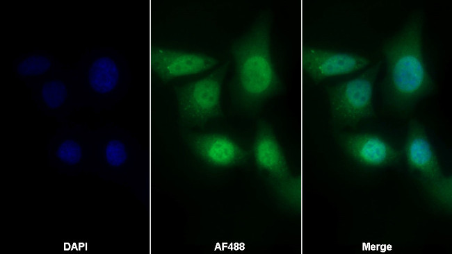 CRM1 Antibody in Immunocytochemistry (ICC/IF)