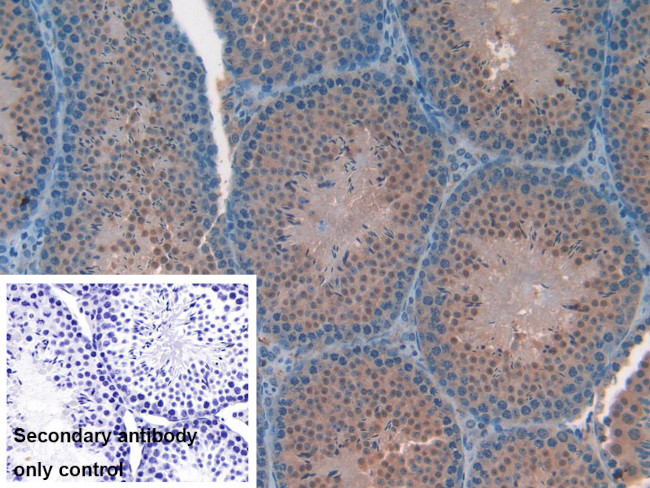 FAM19A2 Antibody in Immunohistochemistry (Paraffin) (IHC (P))