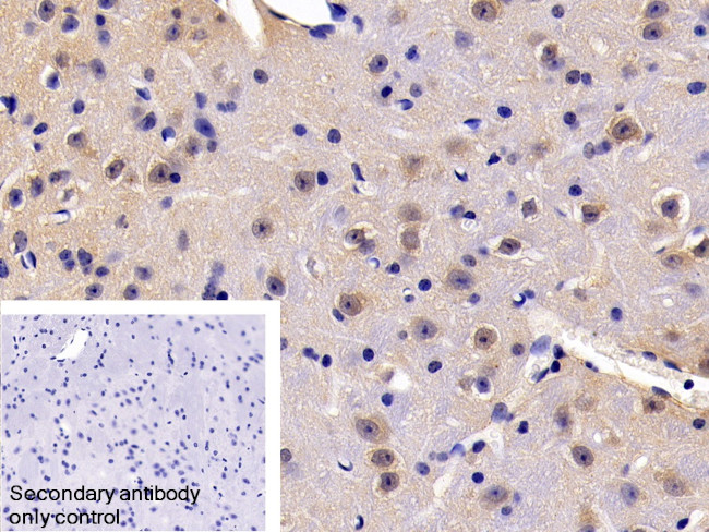 FADD Antibody in Immunohistochemistry (Paraffin) (IHC (P))