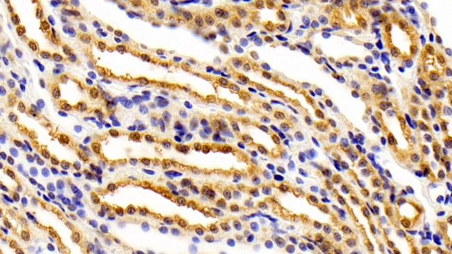 FEZ2 Antibody in Immunohistochemistry (Paraffin) (IHC (P))