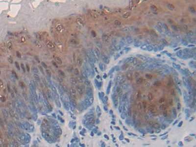 FABP9 Antibody in Immunohistochemistry (Paraffin) (IHC (P))