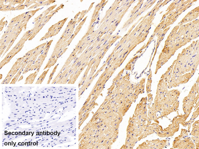 FADS2 Antibody in Immunohistochemistry (Paraffin) (IHC (P))