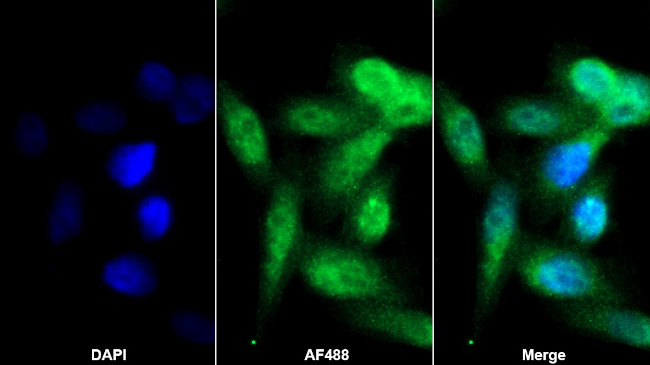 Ferritin Heavy Chain Antibody in Immunocytochemistry (ICC/IF)