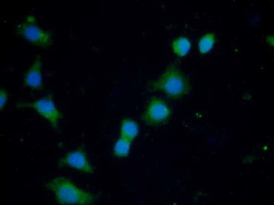 Ferritin Heavy Chain Antibody in Immunocytochemistry (ICC/IF)