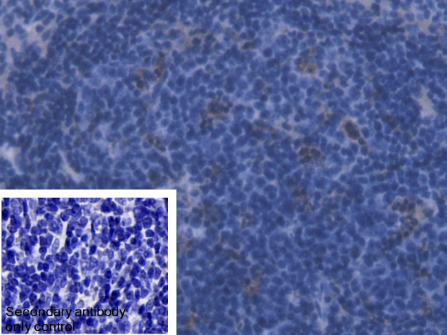 Ferritin Light Chain Antibody in Immunohistochemistry (Paraffin) (IHC (P))