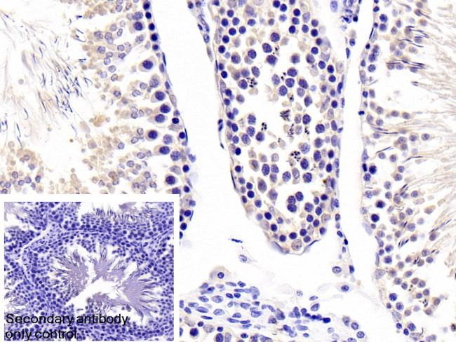 Fibrillarin Antibody in Immunohistochemistry (Paraffin) (IHC (P))