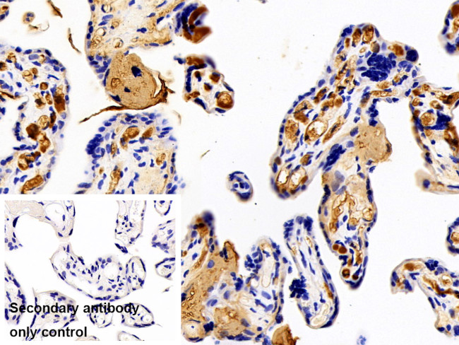 Fibrinogen Beta Chain Antibody in Immunohistochemistry (Paraffin) (IHC (P))