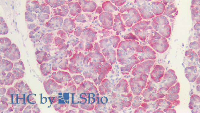 FGL1 Antibody in Immunohistochemistry (Paraffin) (IHC (P))