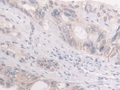 FKBP4 Antibody in Immunohistochemistry (Paraffin) (IHC (P))