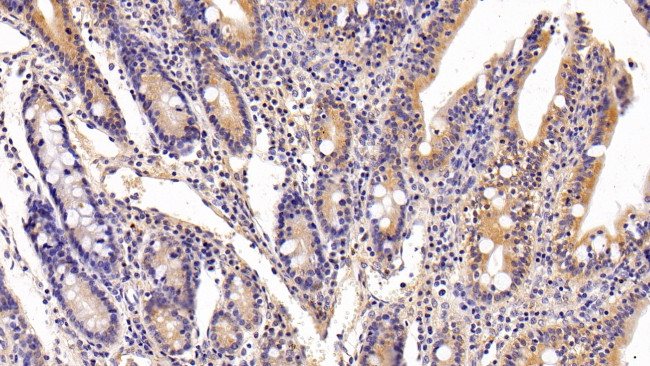 FKBP7 Antibody in Immunohistochemistry (Paraffin) (IHC (P))