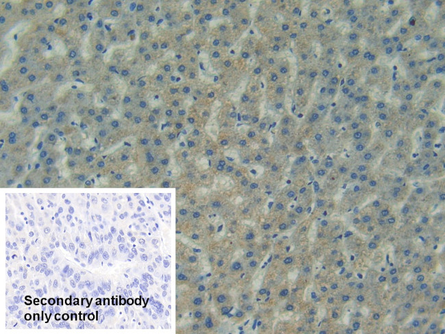 FAK Antibody in Immunohistochemistry (Paraffin) (IHC (P))
