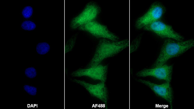 FOLR1 Antibody in Immunocytochemistry (ICC/IF)