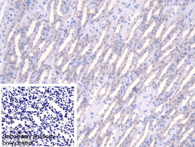 Fumarase Antibody in Immunohistochemistry (Paraffin) (IHC (P))