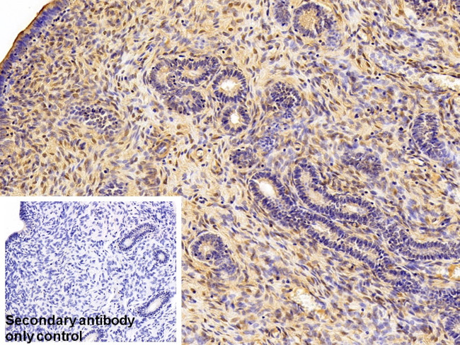 Galectin 1 Antibody in Immunohistochemistry (Paraffin) (IHC (P))