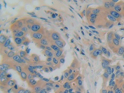 GDI1 Antibody in Immunohistochemistry (Paraffin) (IHC (P))