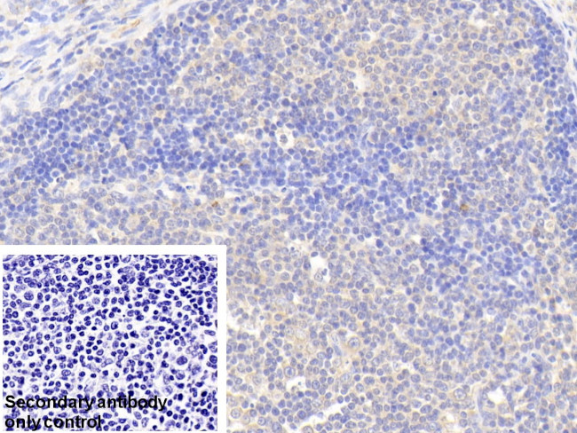 G6PD Antibody in Immunohistochemistry (Paraffin) (IHC (P))