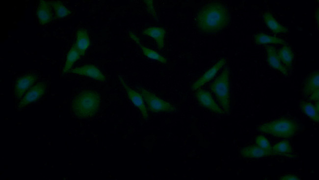 GUSB Antibody in Immunocytochemistry (ICC/IF)