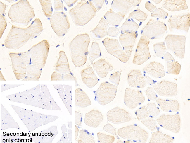 Glutaminase Antibody in Immunohistochemistry (Paraffin) (IHC (P))