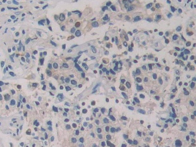 GSR Antibody in Immunohistochemistry (Paraffin) (IHC (P))