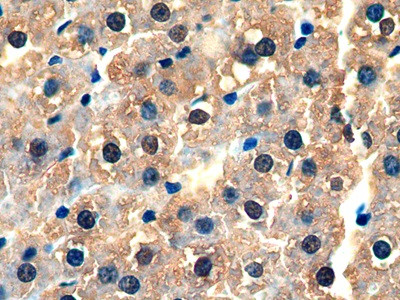 GSTA3 Antibody in Immunohistochemistry (Paraffin) (IHC (P))