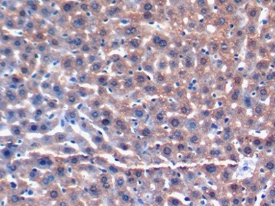 GSTA3 Antibody in Immunohistochemistry (Paraffin) (IHC (P))